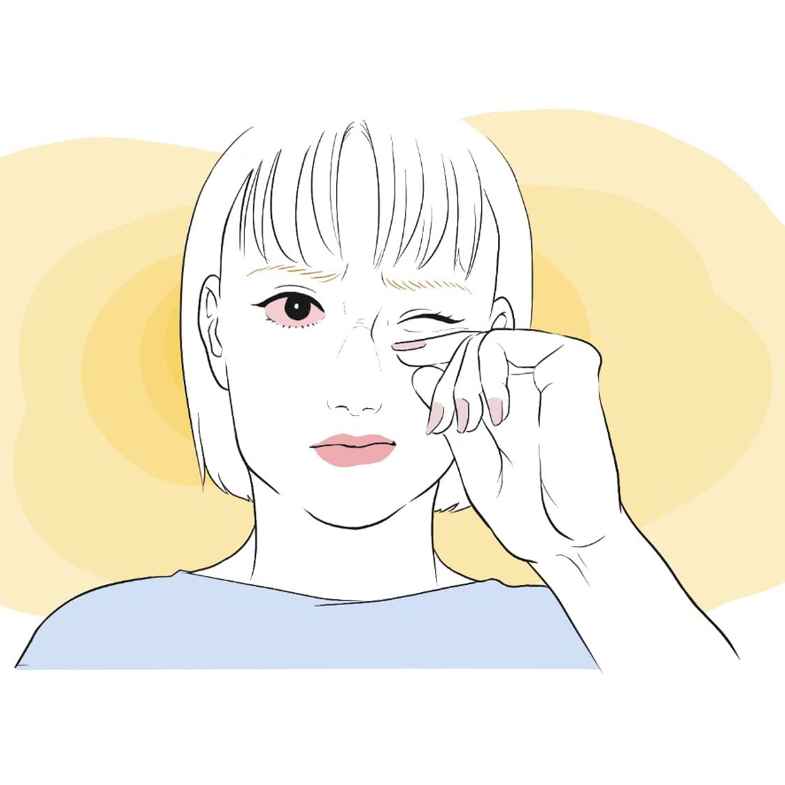 コンタクトレンズで目が充血したらどうする？原因や対処法を紹介